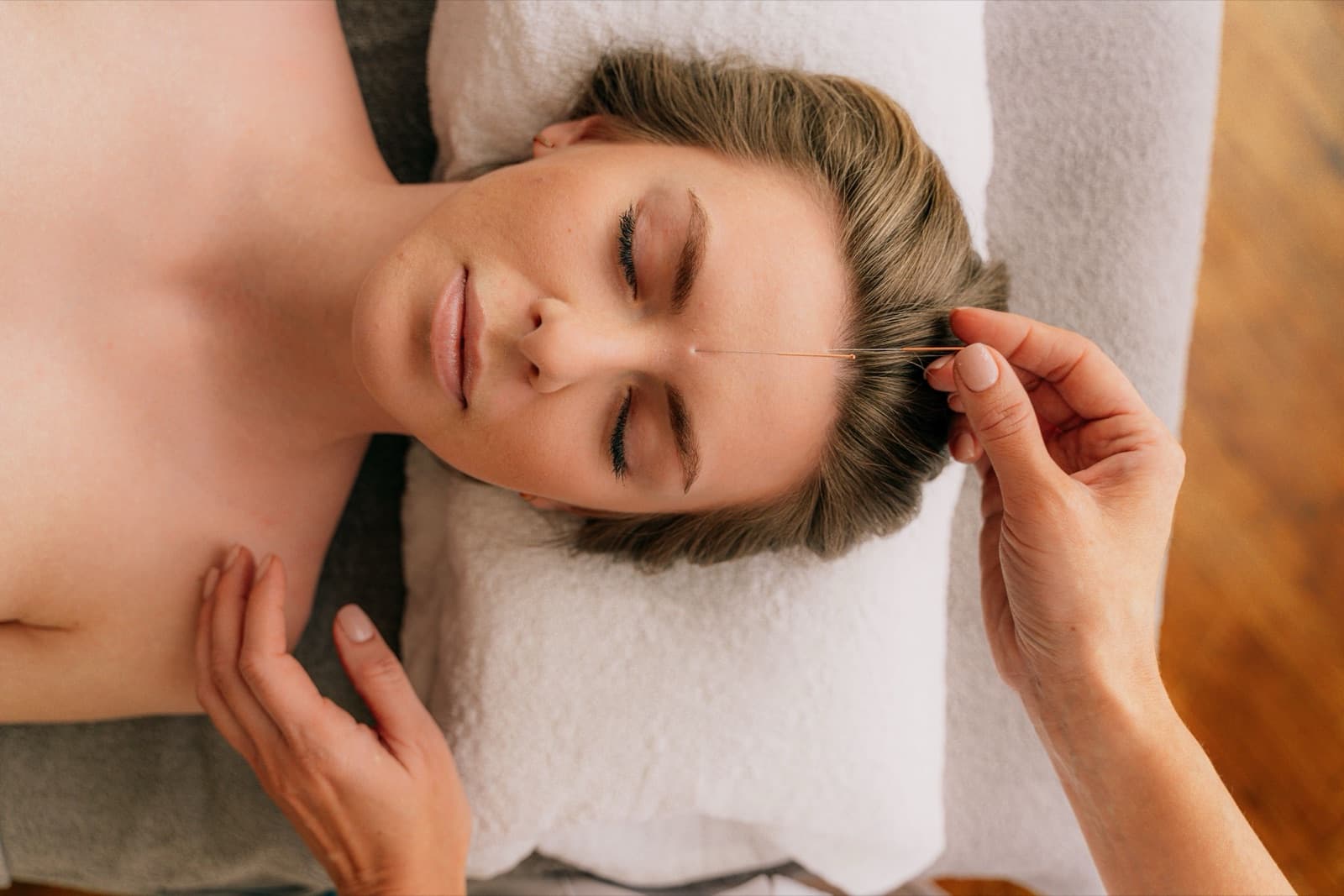 A practitioner placing a fine acupuncture needle near a relaxed client's face